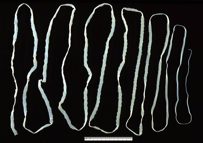 Taenia-saginata